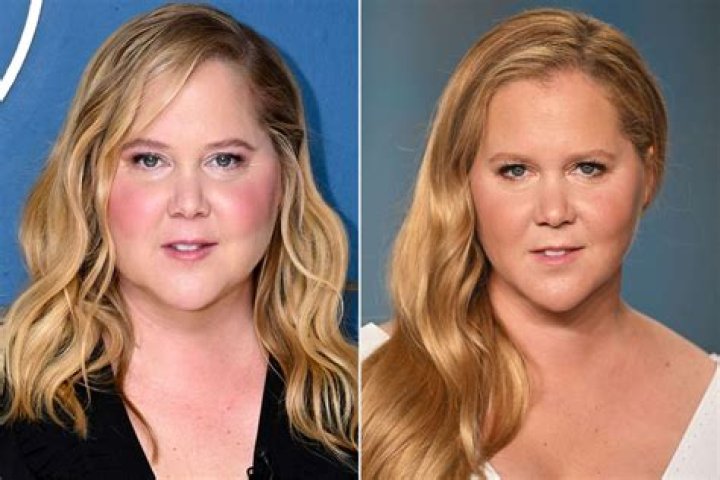 Amy Schumer's Diagnosis: A Deep Dive into How It Impacted Her Career