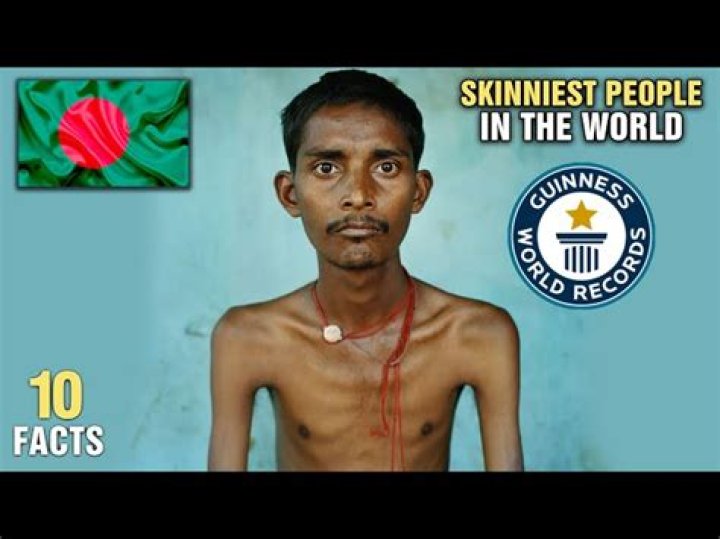Discovering the Skinniest Person in the World: A Fascinating Exploration